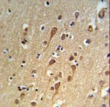 URG4 / URGCP Antibody (aa466-495)