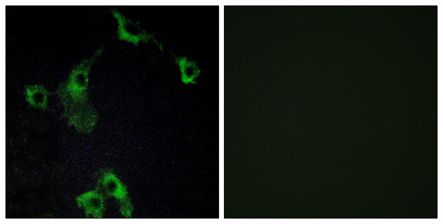 CIDEB Antibody (aa91-140)
