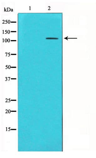 GRM4 / MGLUR4 Antibody