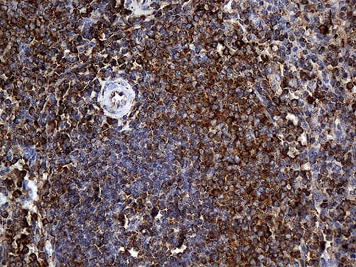 RGS10 Antibody (clone OTI1B10)
