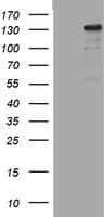 ZEB2 / SIP-1 Antibody (aa1-350, clone OTI4G3)