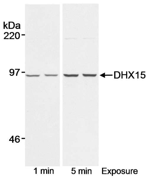 DHX15 Antibody (aa150-200)