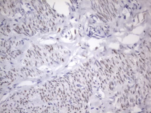 ER Alpha / Estrogen Receptor Antibody (aa1-310, clone OTI2D3)