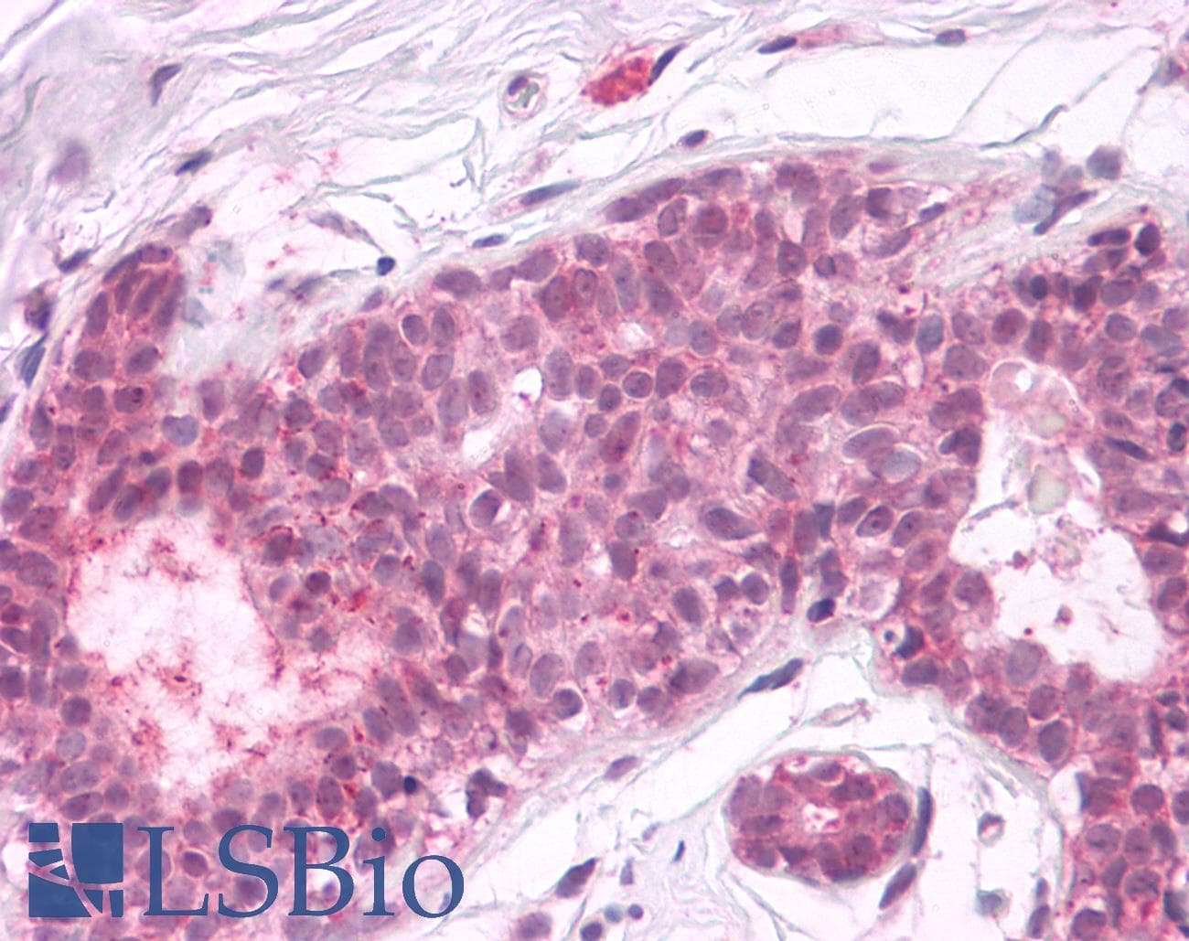 PathPlus™ Polyclonal Rabbit anti-Human PTPRA / RPTP-Alpha Antibody (Cytoplasmic Domain, IHC)