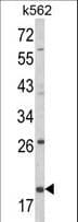 KLRD1 / CD94 Antibody (aa31-57)