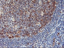 NLN / Neurolysin Antibody (clone OTI1D6)