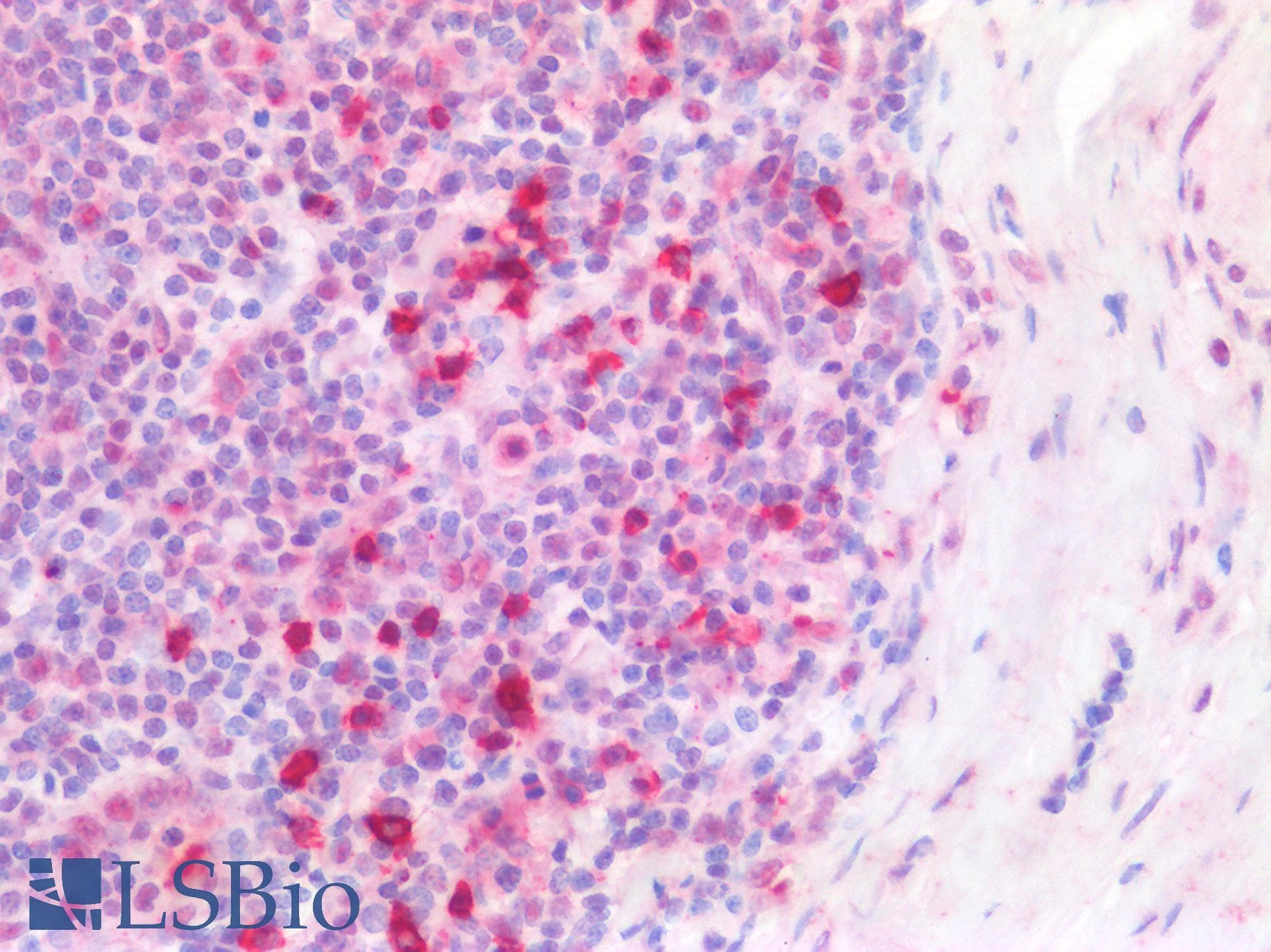 PathPlus™ Polyclonal Rabbit anti-Human SMC1A / SMC1 Antibody (IHC, IF, WB)