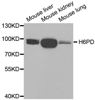 H6PD / G6PDH Antibody