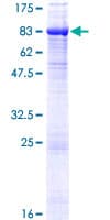 Human TYRP1 / gp75 Protein (Recombinant GST)