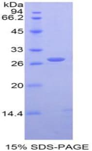 Human HLA-E Protein (Recombinant His-T7)