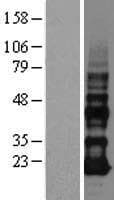 VOPP1 / ECOP Protein (Over-Expression Lysate Myc-DDK (Flag))