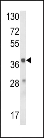 HAO1 Antibody (aa157-185)