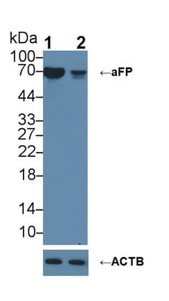 Alpha-Fetoprotein Antibody (aa31-576)