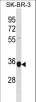 MRPL45 Antibody (aa218-245)