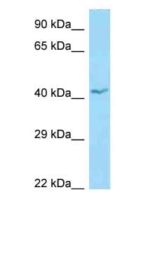 APOL1 / Apolipoprotein L Antibody (aa71-120)