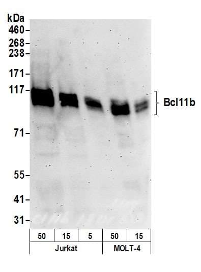 IHC-plus™ BCL11B Antibody (aa850-C-term)