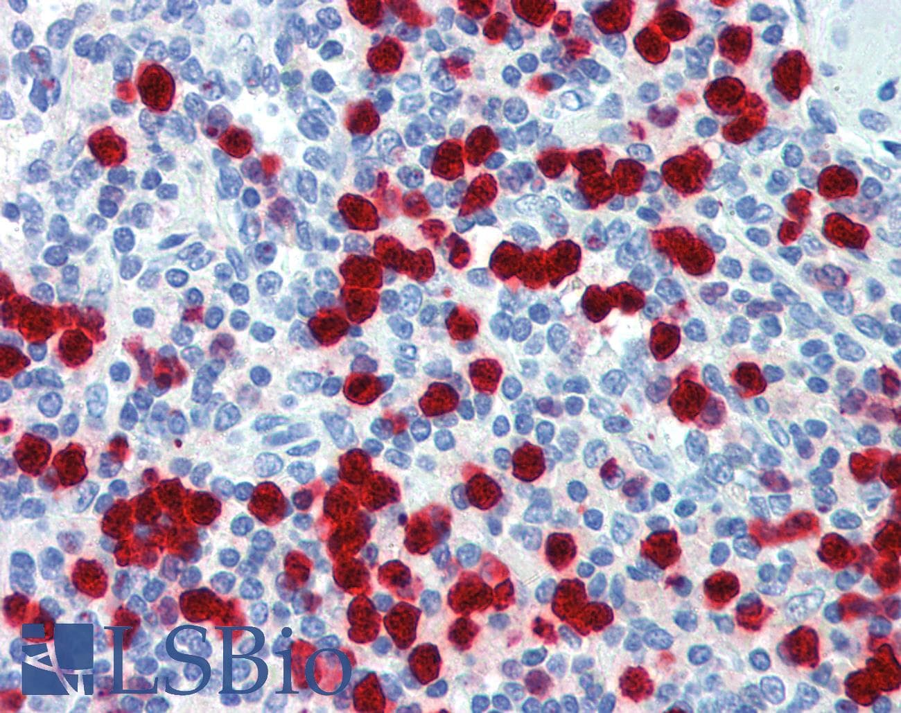 Polyclonal Rabbit anti-Human ZNF395 Antibody (C-Terminus, IHC, WB)