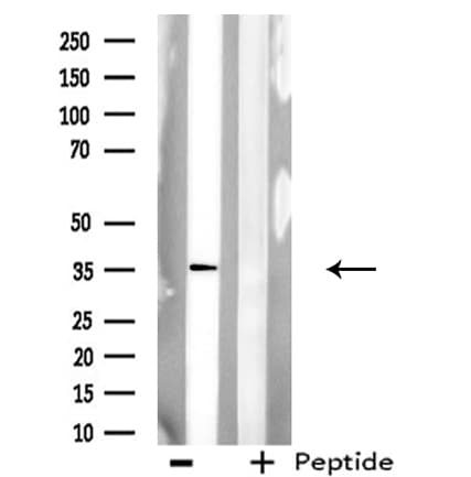 AKR1A1 Antibody