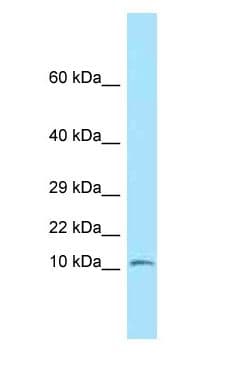 NDUFS6 Antibody (aa16-65)