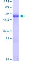 Human LSAMP / LAMP Protein (Recombinant GST)