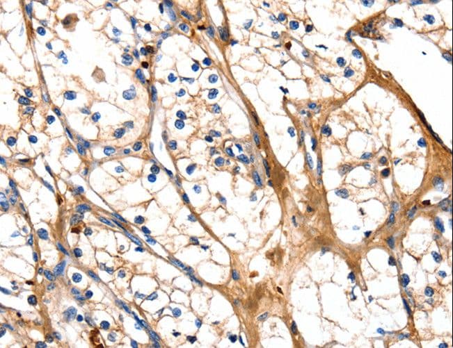 Polyclonal Rabbit anti-Human GSK3A / GSK3 Alpha Antibody (IHC)