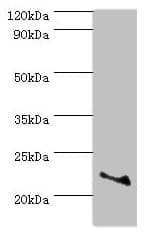 Polyclonal Rabbit anti-Human ASF1A Antibody (aa1-204, IHC, WB)