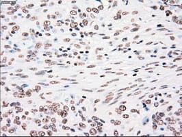 PLK1 / PLK-1 Antibody (clone OTI1D4)