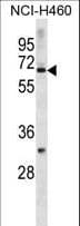 ZNF185 Antibody (aa155-183)