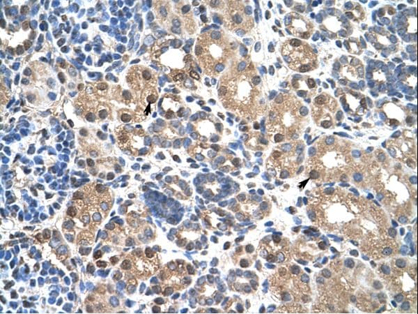 PBX3 Antibody (N-Terminus)