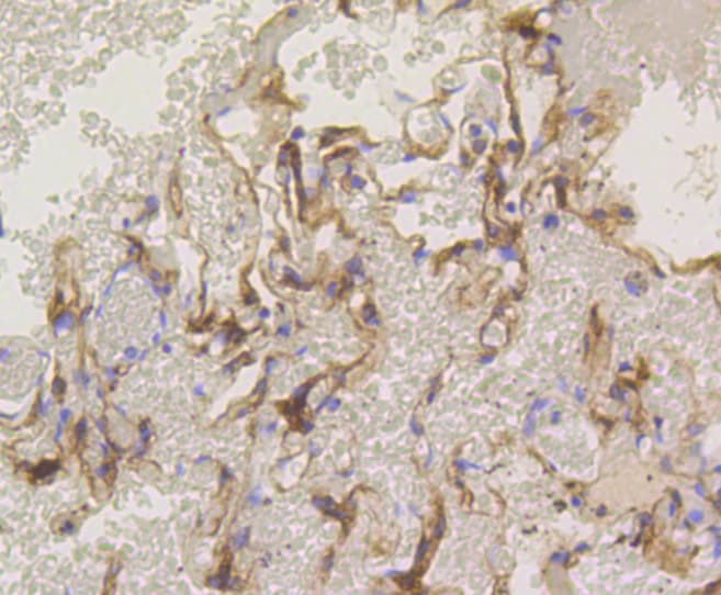 PRKCA / PKC-Alpha Antibody