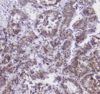 Properdin / CFP Antibody