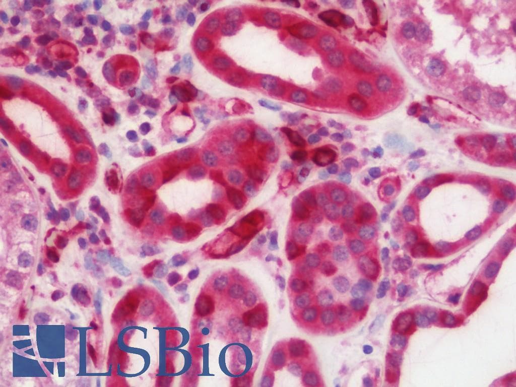 IHC-plus™ ATP6V0A4 Antibody (aa53-295)