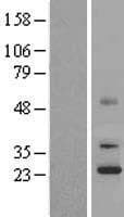 UQCC1/ UQCC Protein (Over-Expression Lysate Myc-DDK (Flag))