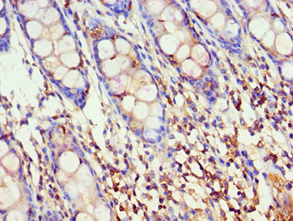 Polyclonal Rabbit anti-Human AKAP5 / AKAP79 Antibody (aa1-270, IHC)
