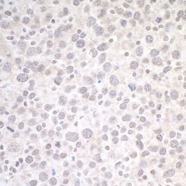 CTCF Antibody (aa650-700)
