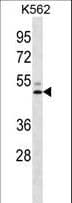LIPC / Hepatic Lipase Antibody (aa310-338)
