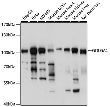 Polyclonal Rabbit anti-Human GOLGA1 / Golgin-97 Antibody (IF, WB)