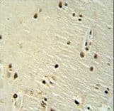 Polyclonal Rabbit anti-Human XRCC6 / Ku70 Antibody (aa228-254, IHC, IF, WB)