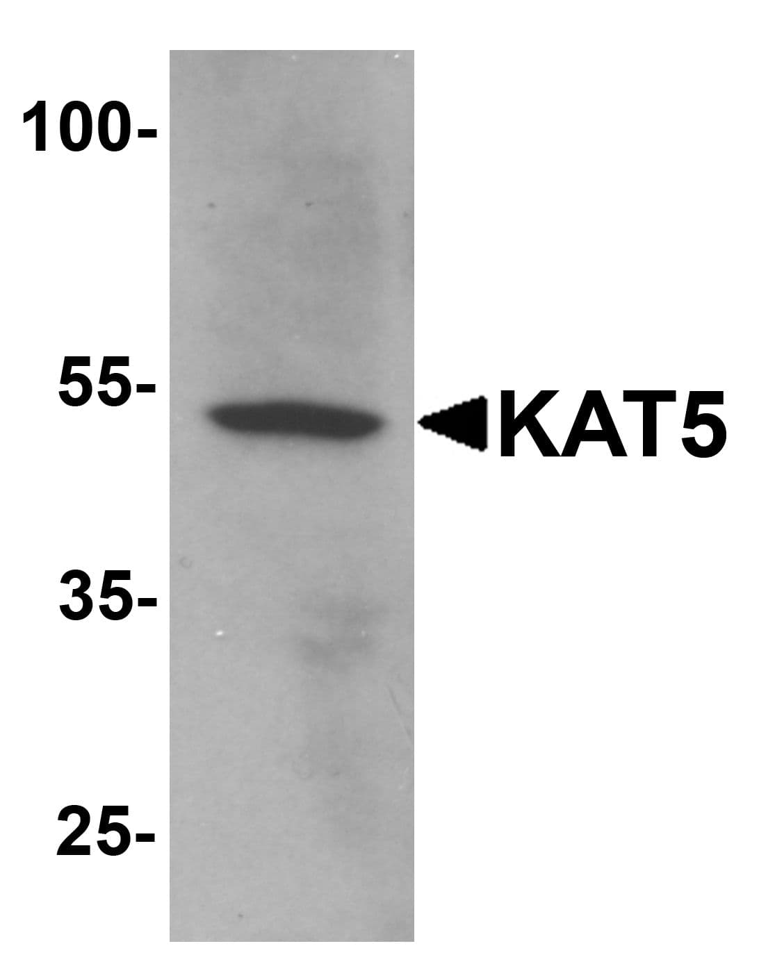 KAT5 / TIP60 Antibody