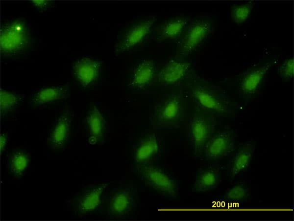 PSMB6 Antibody (clone S51)