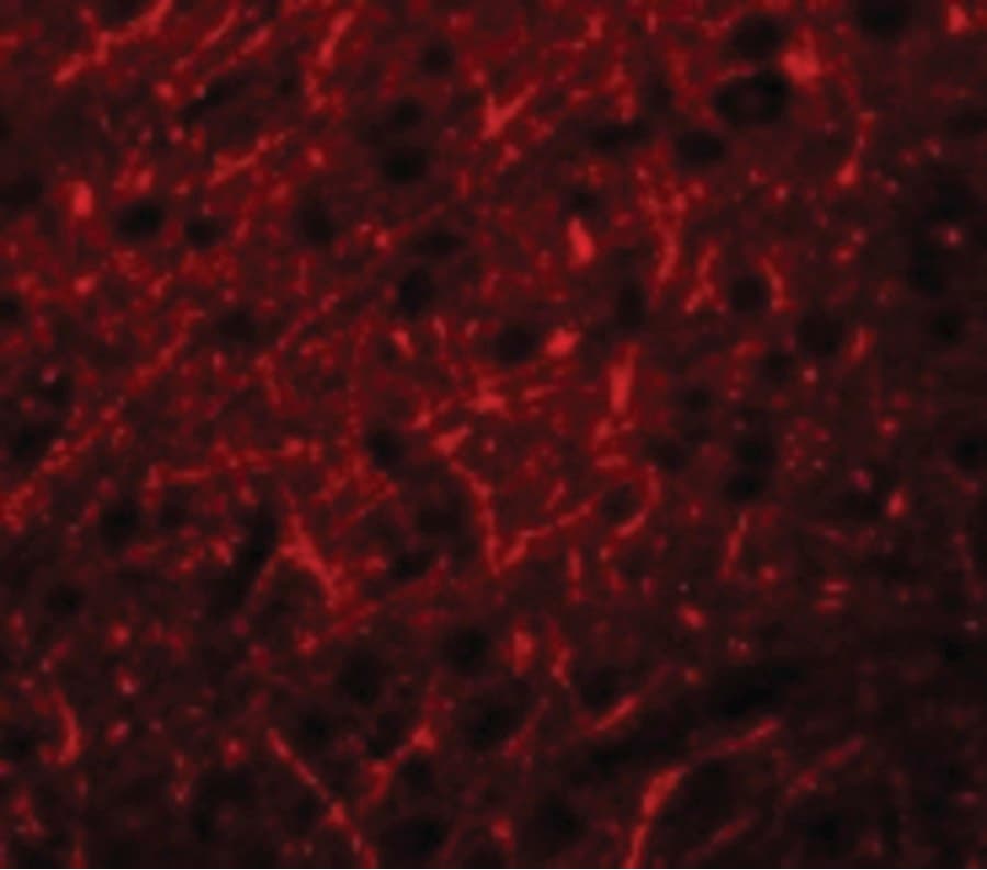 PRDM16 Antibody