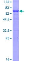 Human TMOD2 / Tropomodulin 2 Protein (Recombinant GST)