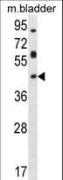 HOXD13 Antibody (aa202-230)