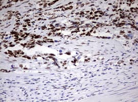 CD5 Antibody (clone OTI10F4)