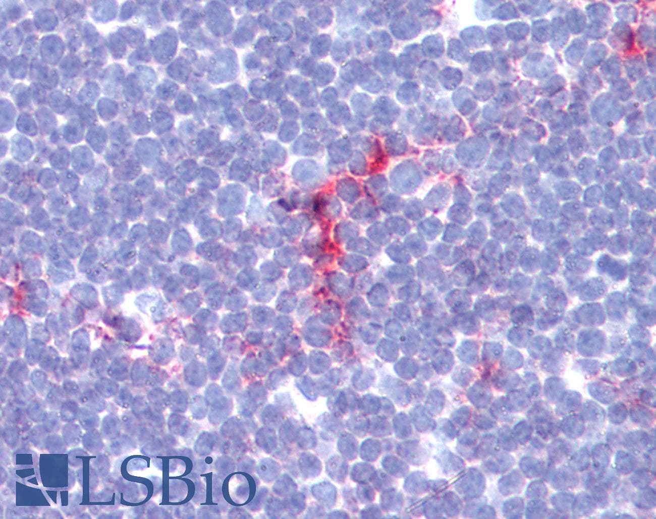 IHC-plus™ Polyclonal Rabbit anti-Human CD1A Antibody (clone L21-A, IHC)