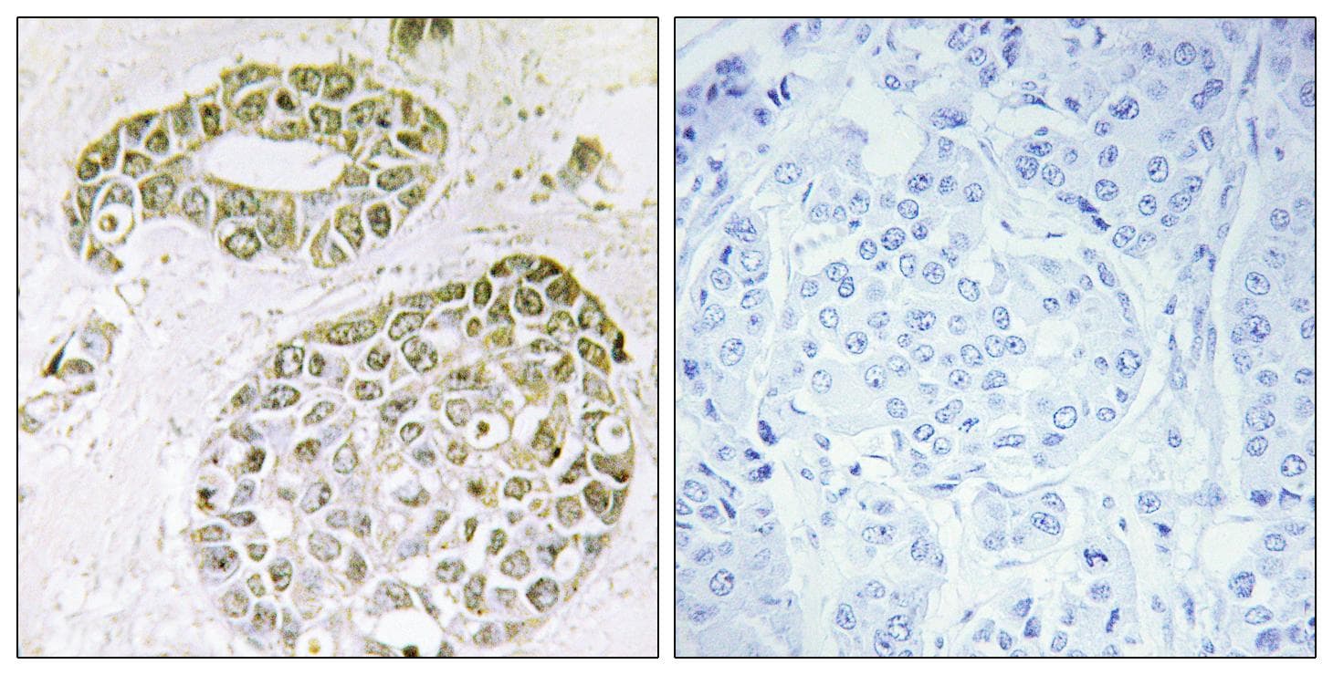 Polyclonal Rabbit anti-Human HNRPM / HNRNPM Antibody (IHC, IF, WB)