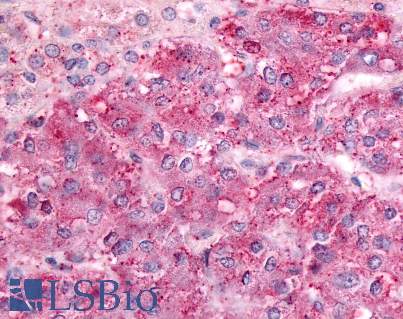 IHC-plus™ GPRC5C Antibody (C-Terminus)