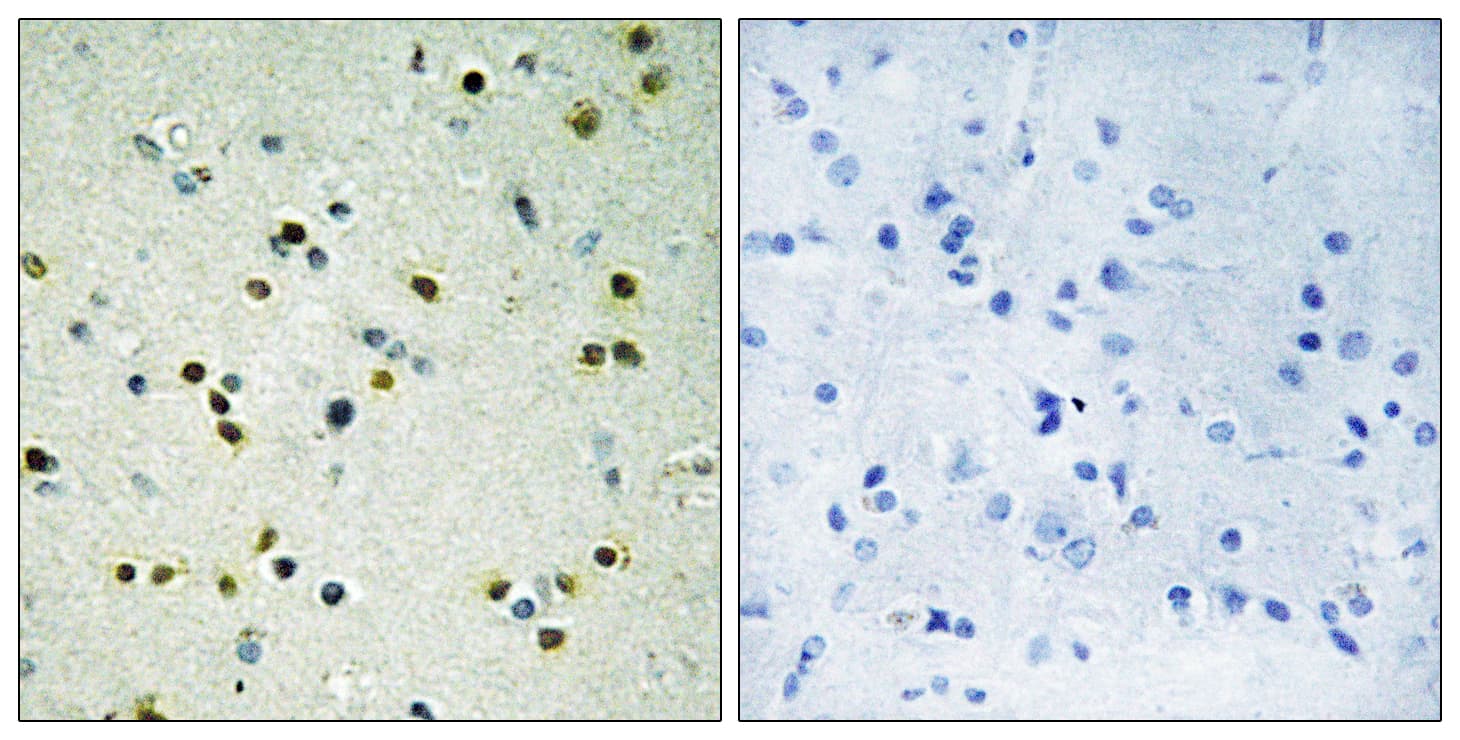 KDM4B / JMJD2B Antibody