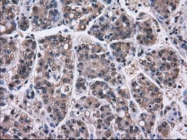 Monoclonal Mouse anti-Human PSMD10 / Gankyrin Antibody (clone OTI3F6, WB)