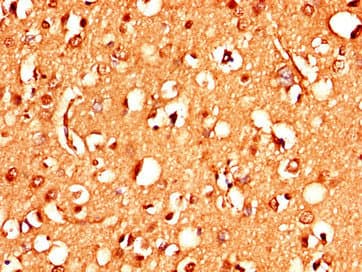 STIM2 Antibody